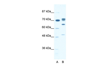 DDX21 Rabbit Polyclonal Antibody