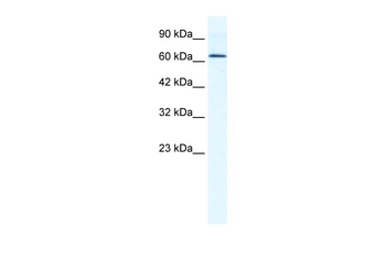 DDX21 Rabbit Polyclonal Antibody