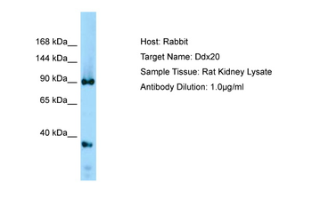 Ddx20 Rabbit Polyclonal Antibody