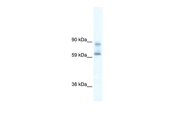 DDX42 Rabbit Polyclonal Antibody