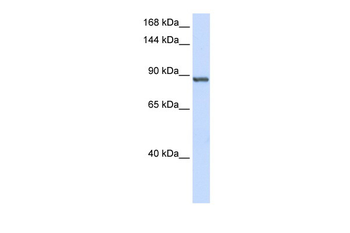 INTS6 Rabbit Polyclonal Antibody