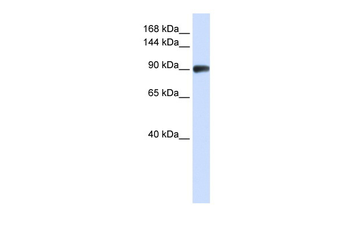 RAD54B Rabbit Polyclonal Antibody