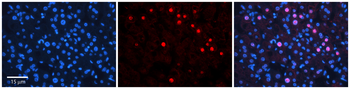 RAD54B Rabbit Polyclonal Antibody