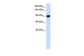 RAD54B Rabbit Polyclonal Antibody