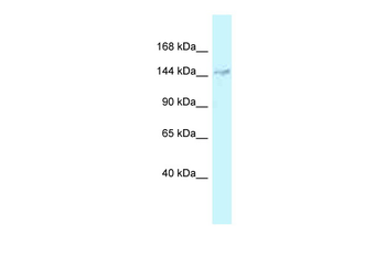 DHX38 Rabbit Polyclonal Antibody