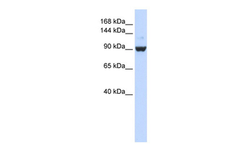 DHX34 Rabbit Polyclonal Antibody