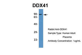 DDX41 Rabbit Polyclonal Antibody
