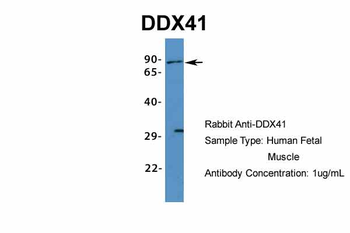 DDX41 Rabbit Polyclonal Antibody