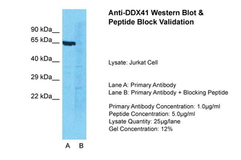 DDX41 Rabbit Polyclonal Antibody