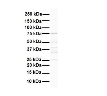 DDX41 Rabbit Polyclonal Antibody