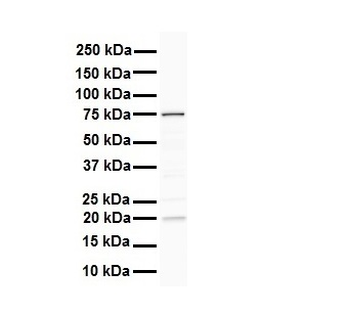 DDX41 Rabbit Polyclonal Antibody