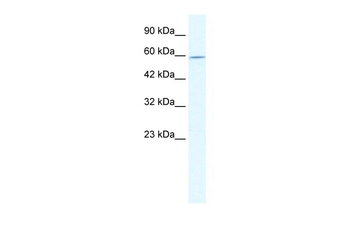 DDX47 Rabbit Polyclonal Antibody