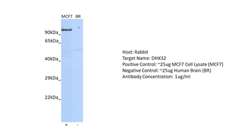 DHX32 Rabbit Polyclonal Antibody