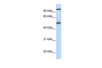 DHX32 Rabbit Polyclonal Antibody