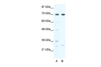 WRNIP1 Rabbit Polyclonal Antibody