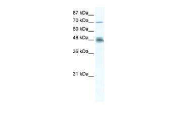 DDX50 Rabbit Polyclonal Antibody
