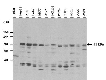 DDX54 Rabbit Polyclonal Antibody