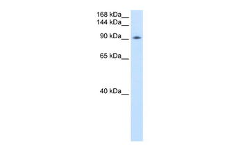 DDX54 Rabbit Polyclonal Antibody