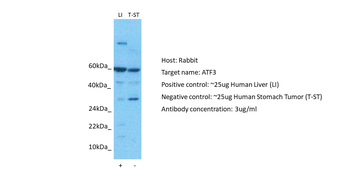 ATF3 Rabbit Polyclonal Antibody