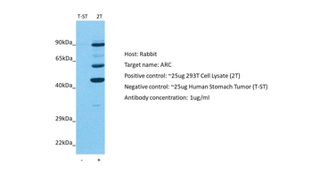 ARC Rabbit Polyclonal Antibody