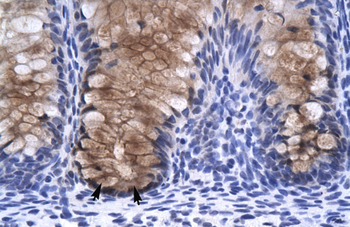 ANXA1 Rabbit Polyclonal Antibody