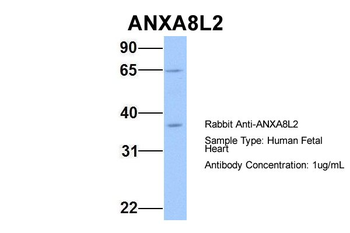ANXA8L2 Rabbit Polyclonal Antibody