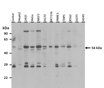 ANXA11 Rabbit Polyclonal Antibody
