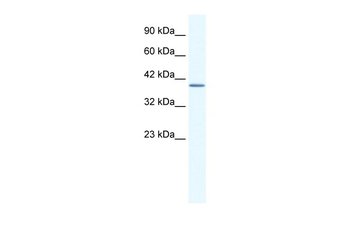 ANXA13 Rabbit Polyclonal Antibody