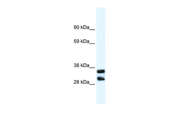 ANXA13 Rabbit Polyclonal Antibody