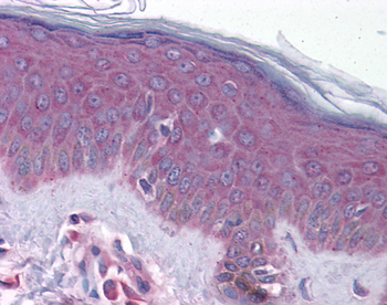 GJB1 Rabbit Polyclonal Antibody