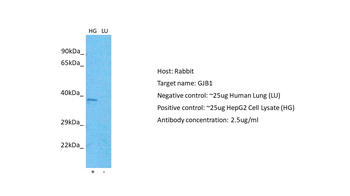 GJB1 Rabbit Polyclonal Antibody