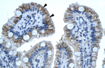 GJB1 Rabbit Polyclonal Antibody