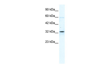 GJB1 Rabbit Polyclonal Antibody