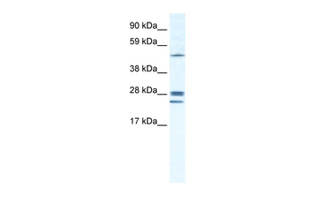 GJB2 Rabbit Polyclonal Antibody