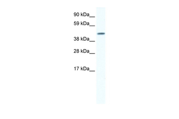 GJA5 Rabbit Polyclonal Antibody