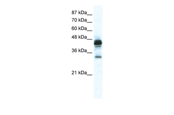 GJE1 Rabbit Polyclonal Antibody