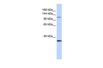 MCM2 Rabbit Polyclonal Antibody