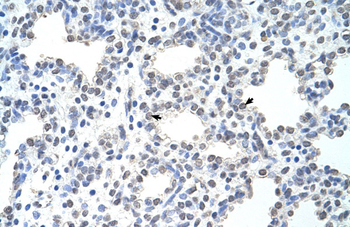 MCM6 Rabbit Polyclonal Antibody