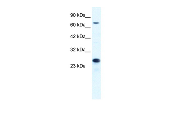 MCM6 Rabbit Polyclonal Antibody
