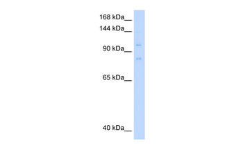 MCM8 Rabbit Polyclonal Antibody