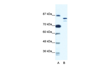MCM8 Rabbit Polyclonal Antibody