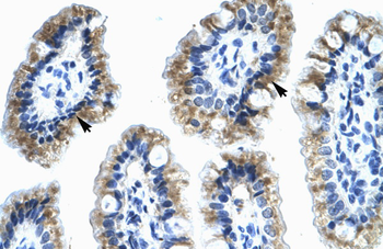 ANXA4 Rabbit Polyclonal Antibody