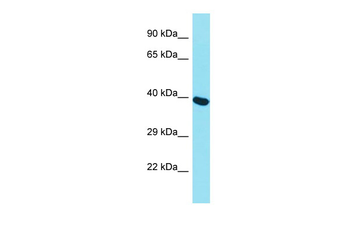 MCM7 Rabbit Polyclonal Antibody