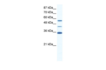 ALX4 Rabbit Polyclonal Antibody