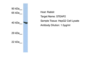 STEAP2 Rabbit Polyclonal Antibody