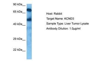 KCND3 Rabbit Polyclonal Antibody