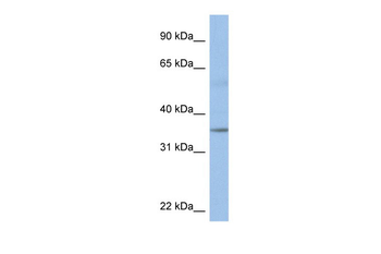 KCTD4 Rabbit Polyclonal Antibody