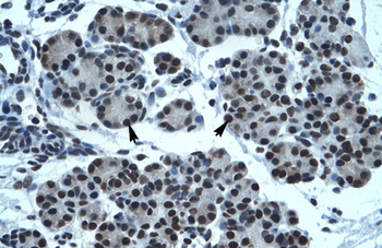 TPTE Rabbit Polyclonal Antibody