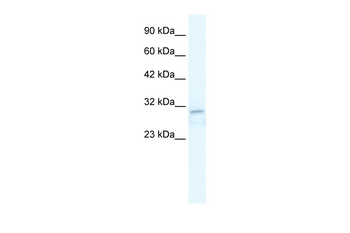 TRPM3 Rabbit Polyclonal Antibody