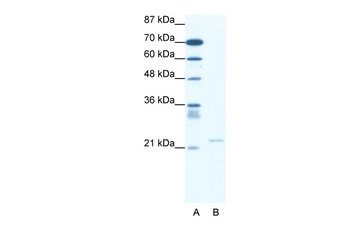 TRPM3 Rabbit Polyclonal Antibody